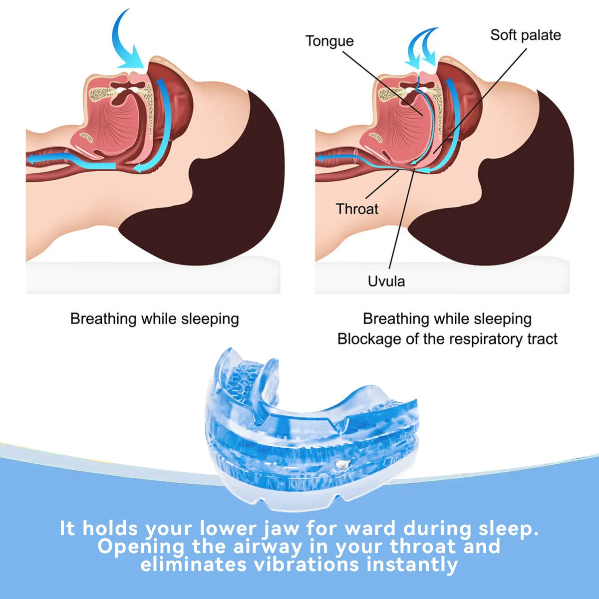 Anti-Snore Bruxism Mouth Guard