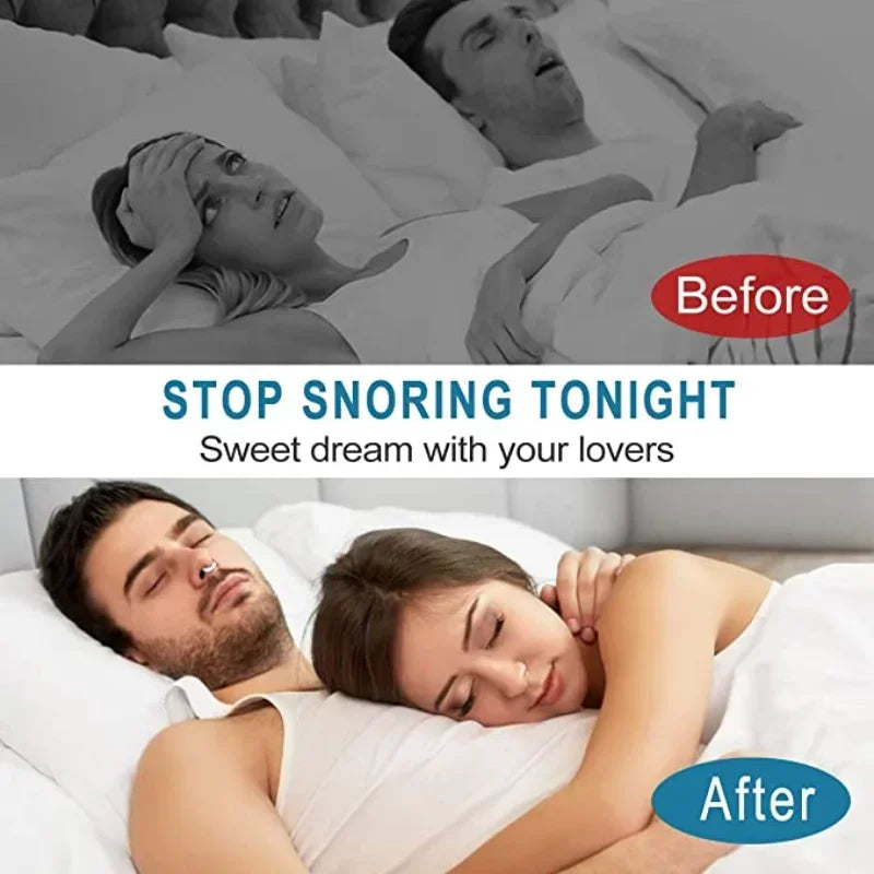 Anti-Snoring Magnetic Nose Clip