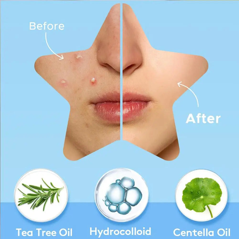 Colorful Star Acne Patch